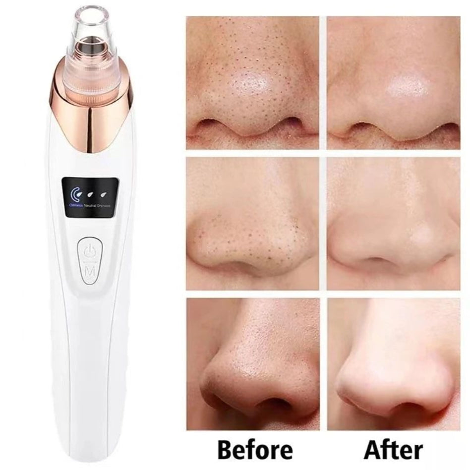 Pro Derma Suction