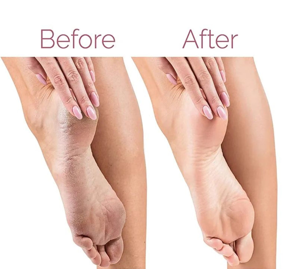 Velura Pro Foot File